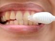 Якщо у вас жовтуваті зуби - ви щасливчик: Геть стоматологічні міфи