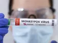 У Московській області в місцевих виявили рідкісну хворобу (фото)