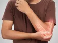 Варто включити в раціон! Медики назвали популярний продукт, який зміцнює кістки